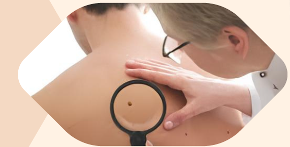 Immagine che raffigura Serata dedicata alla prevenzione dei tumori della pelle